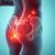 Zablokowanie stawu krzyżowo-biodrowego: objawy, przyczyny i terapia